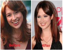 Ellie Kemper before surgery